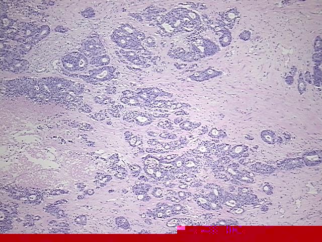 4x Image