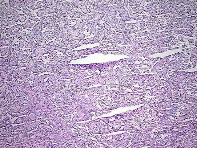 4x Image