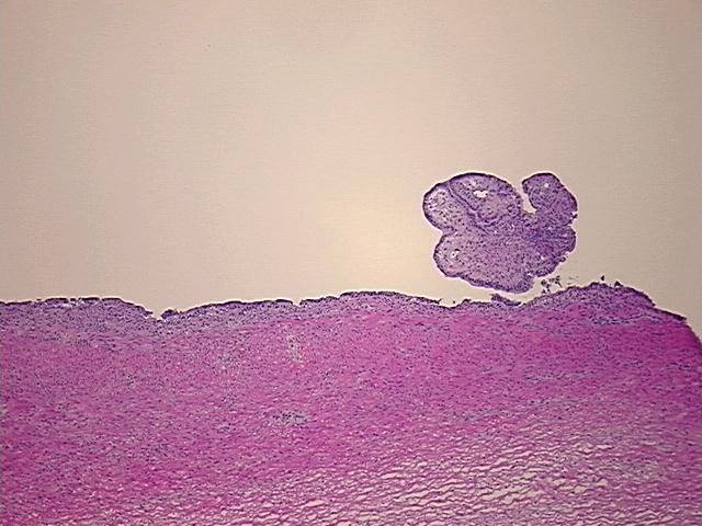 4x Image