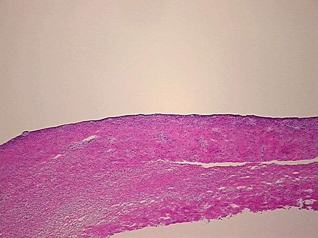 4x Image