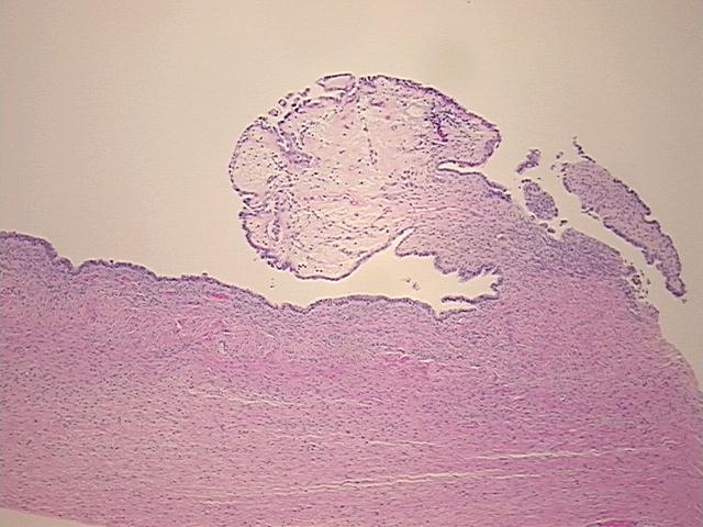 4x Image