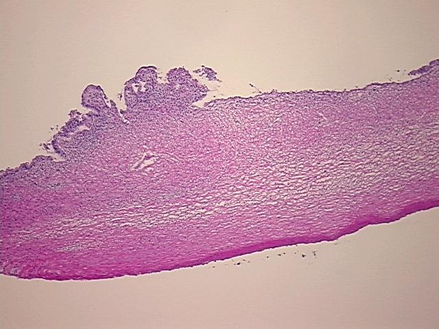 4x Image