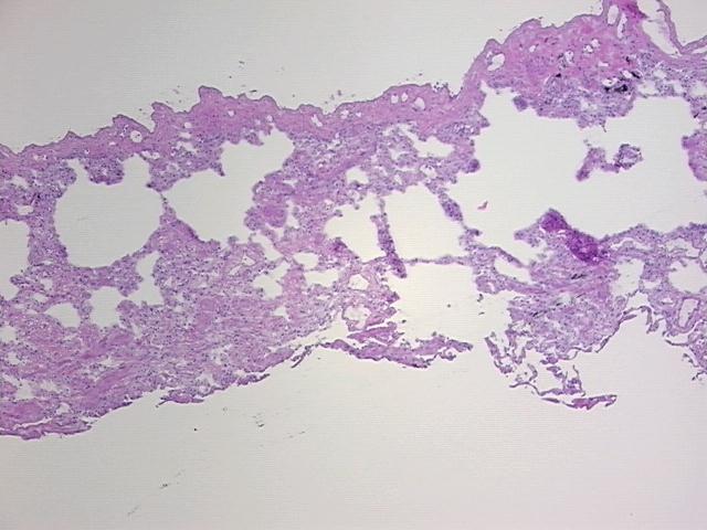 4x Image