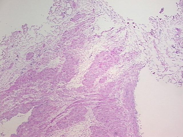 4x Image