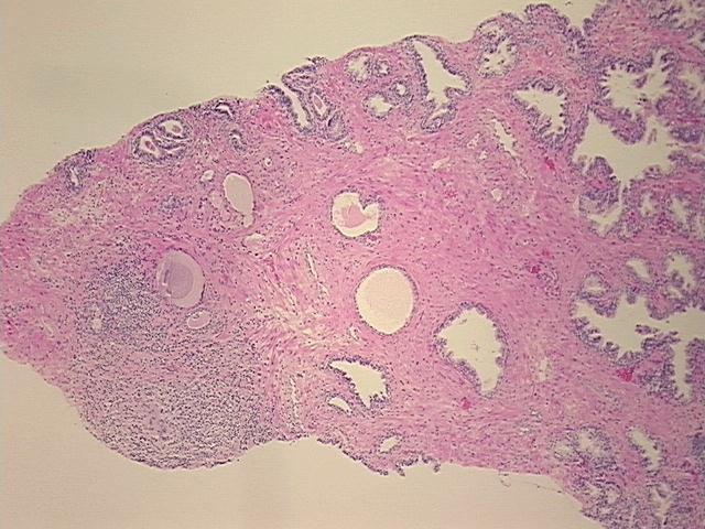4x Image