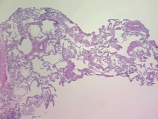 4x Image