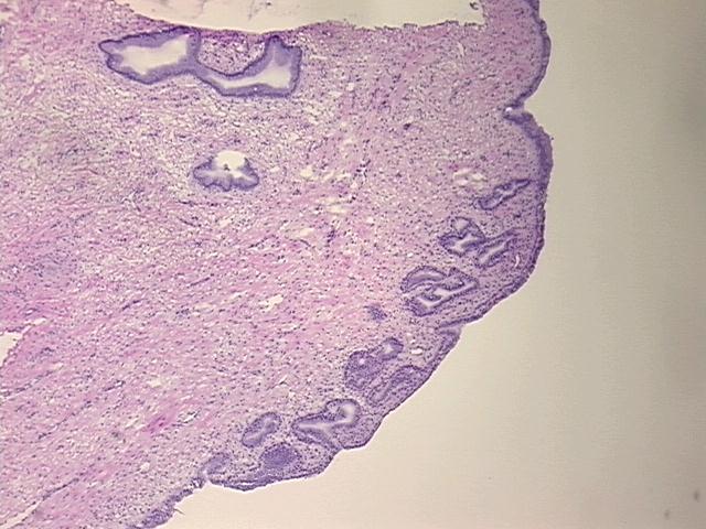 4x Image