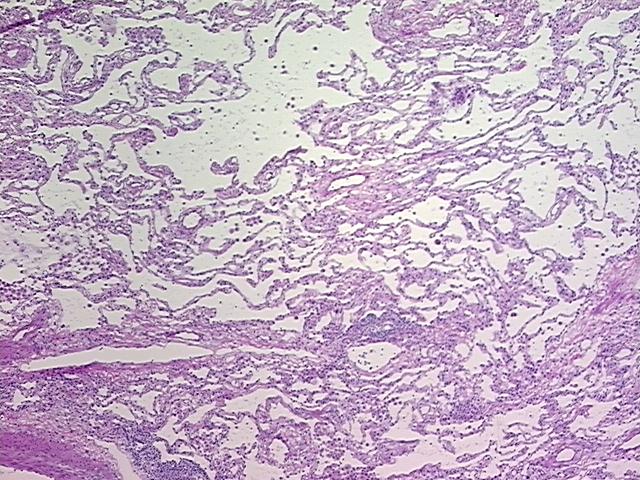 4x Image