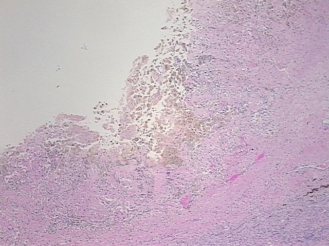 4x Image