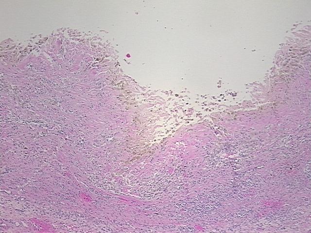 4x Image