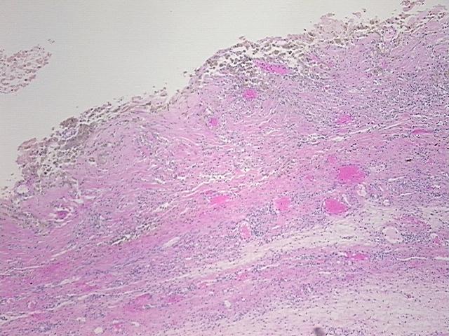 4x Image