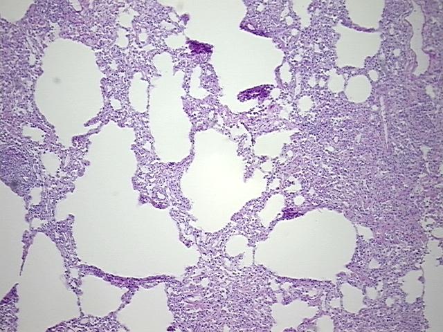 4x Image