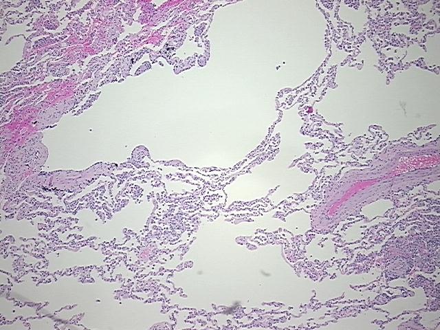 4x Image