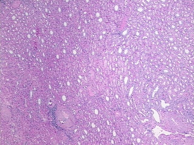 4x Image