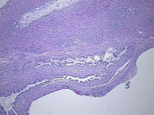 4x Image