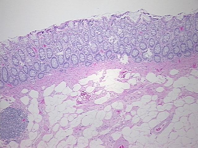 4x Image