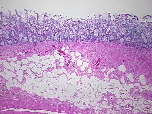 4x Image