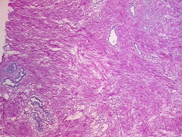 Frozen Tissue Sections, Prostate