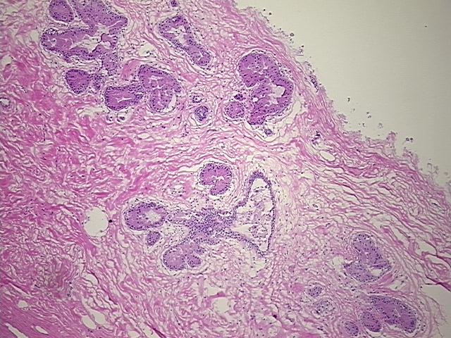 4x Image