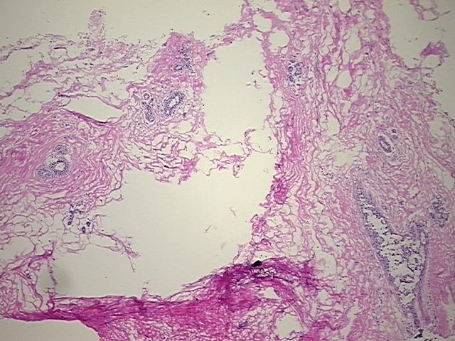4x Image