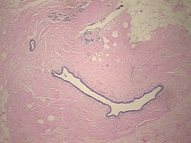 4x Image