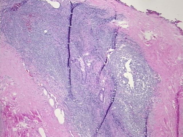 Tissue FFPE Sections, Appendix | CS708674 | OriGene Technologies Inc.