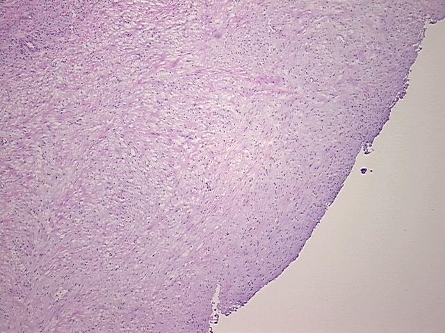4x Image