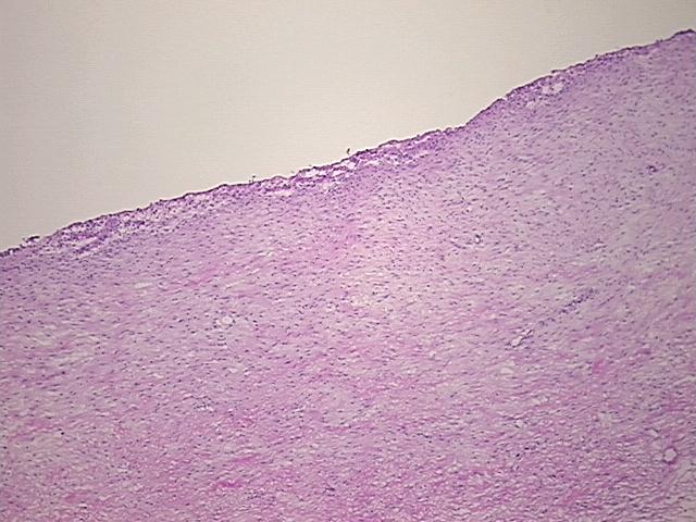 4x Image