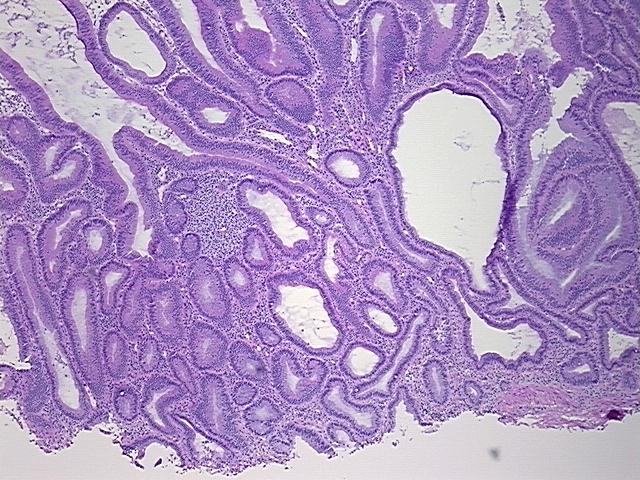 4x Image