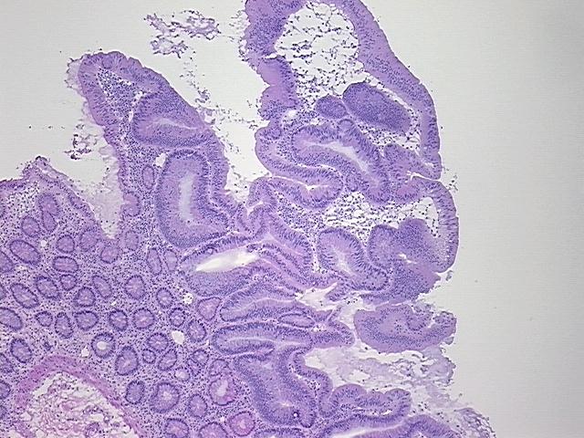 4x Image