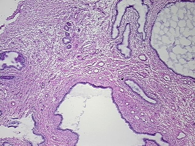 4x Image