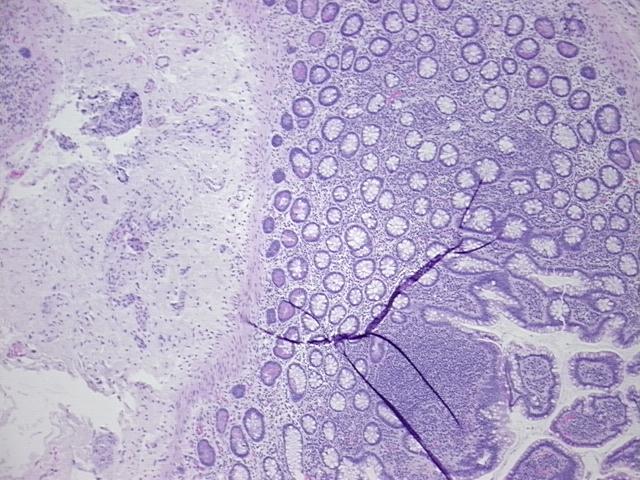 4x Image