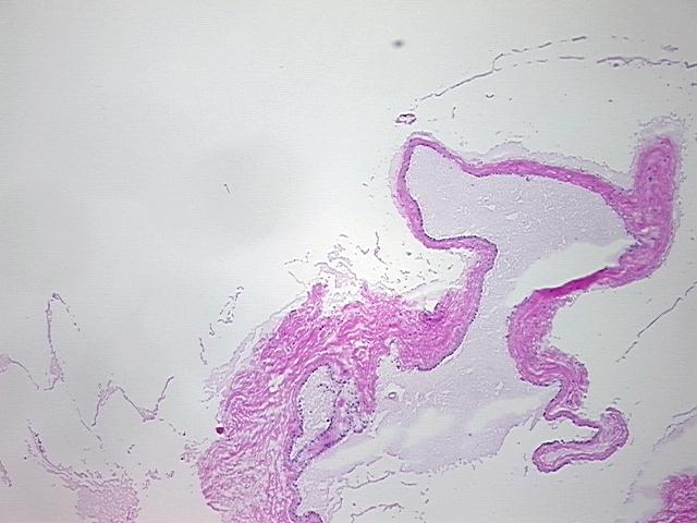 4x Image