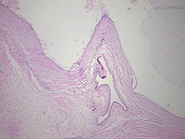 4x Image