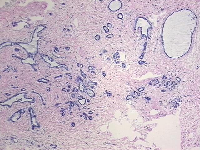 4x Image