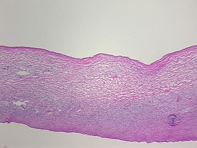 4x Image