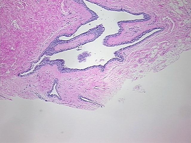 4x Image