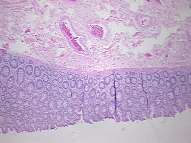 4x Image
