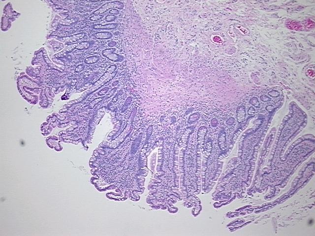4x Image
