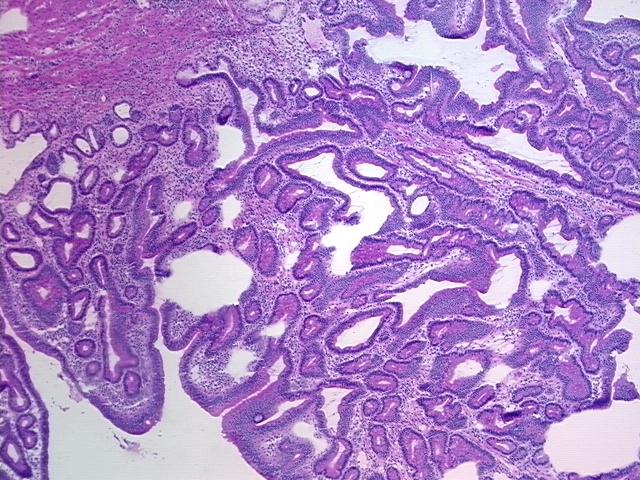 Frozen Tissue Sections, Duodenum | CS529662 | OriGene Technologies Inc.