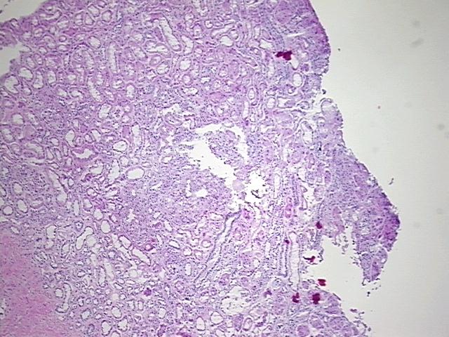 4x Image