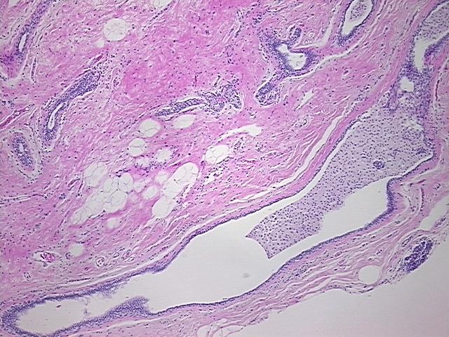 4x Image