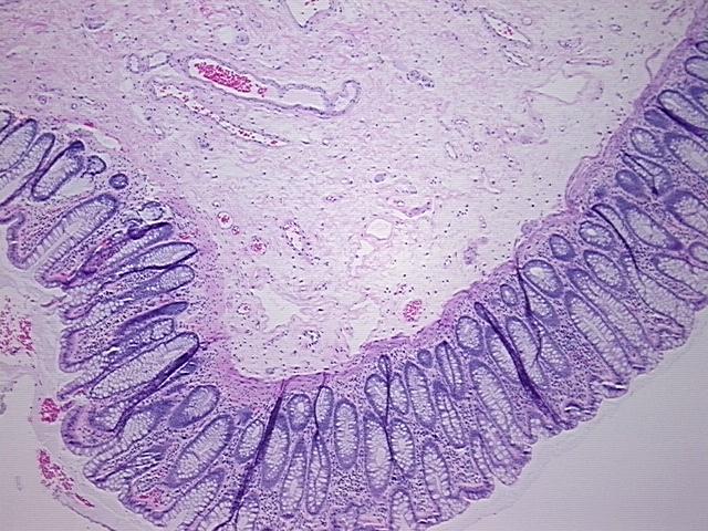 4x Image