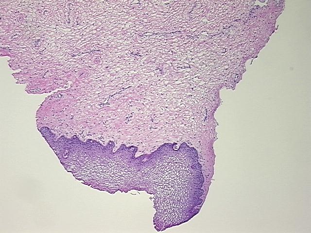 4x Image