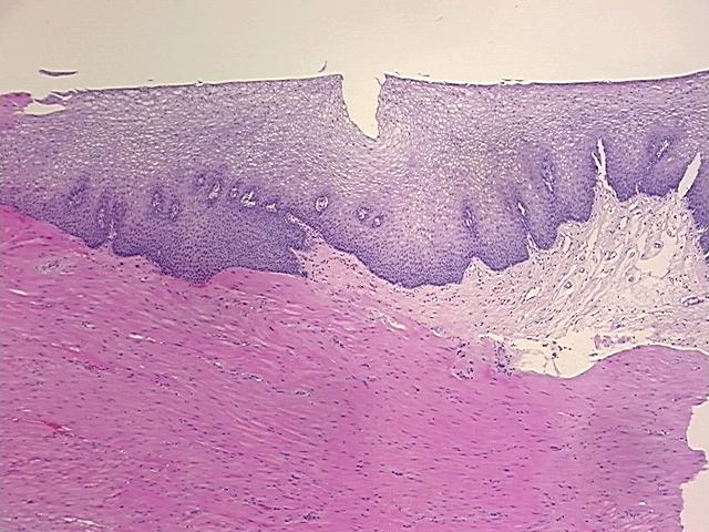 4x Image