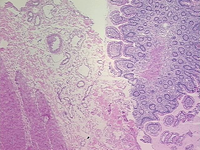 4x Image