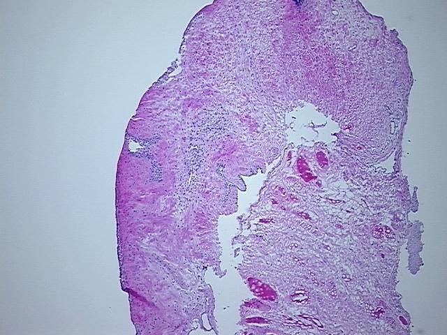 4x Image