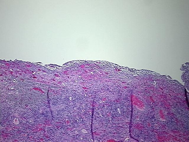 4x Image