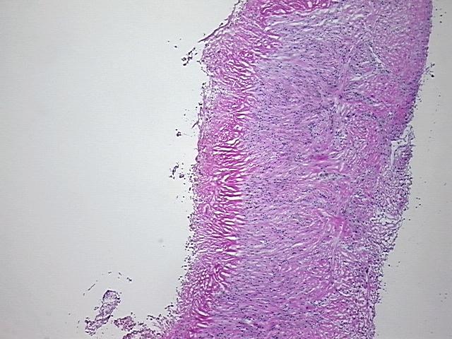 4x Image