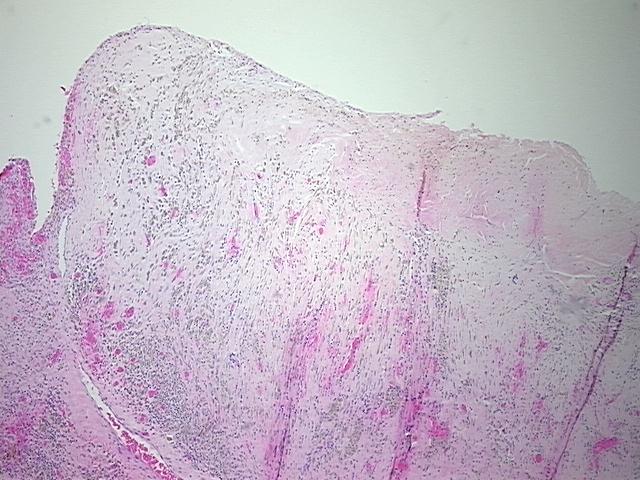 4x Image